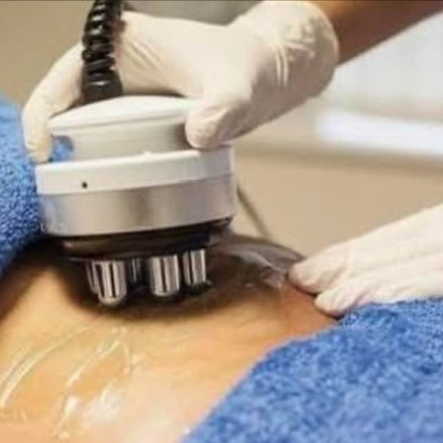 10 sessions Focused skin tighten at Sculpted Body Renewal in Villa Rica, GA